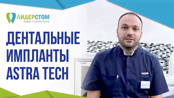 Система дентальных имплантов AstraTech 🤔 Зубной имплант Астра Теч
